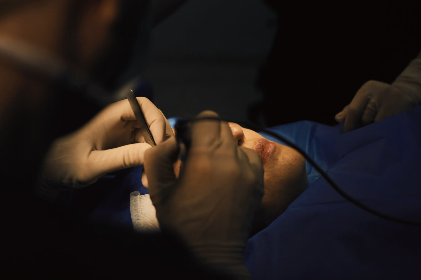 cel-mai-bun-chirurg-blefaroplastie-4